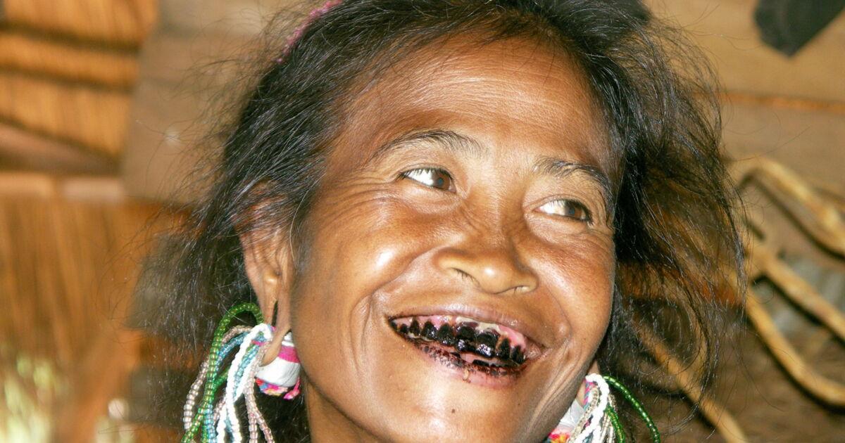 Pourquoi les dents noires étaient-elles considérées comme belles au Japon ?