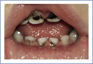 Que signifient les dents noires au Japon ?